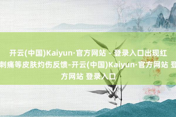 开云(中国)Kaiyun·官方网站 - 登录入口出现红、热、刺痛等皮肤灼伤反馈-开云(中国)Kaiyun·官方网站 登录入口